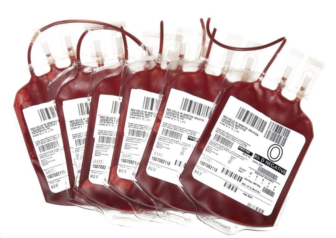 Препарат донор. Гемаконы для переливания крови. Пакет с кровью для переливания этикетка. Пакет с кровью для переливания.